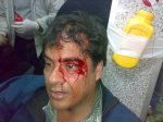 Thugs and secret police attack the protesters in Tahrir Square 2 feb